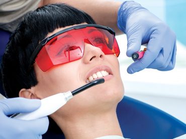 Teeth Whitening (Bleaching)