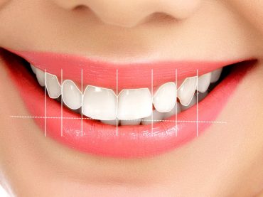 Aesthetic Smile Design